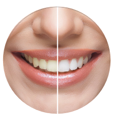 Teeth Close Up