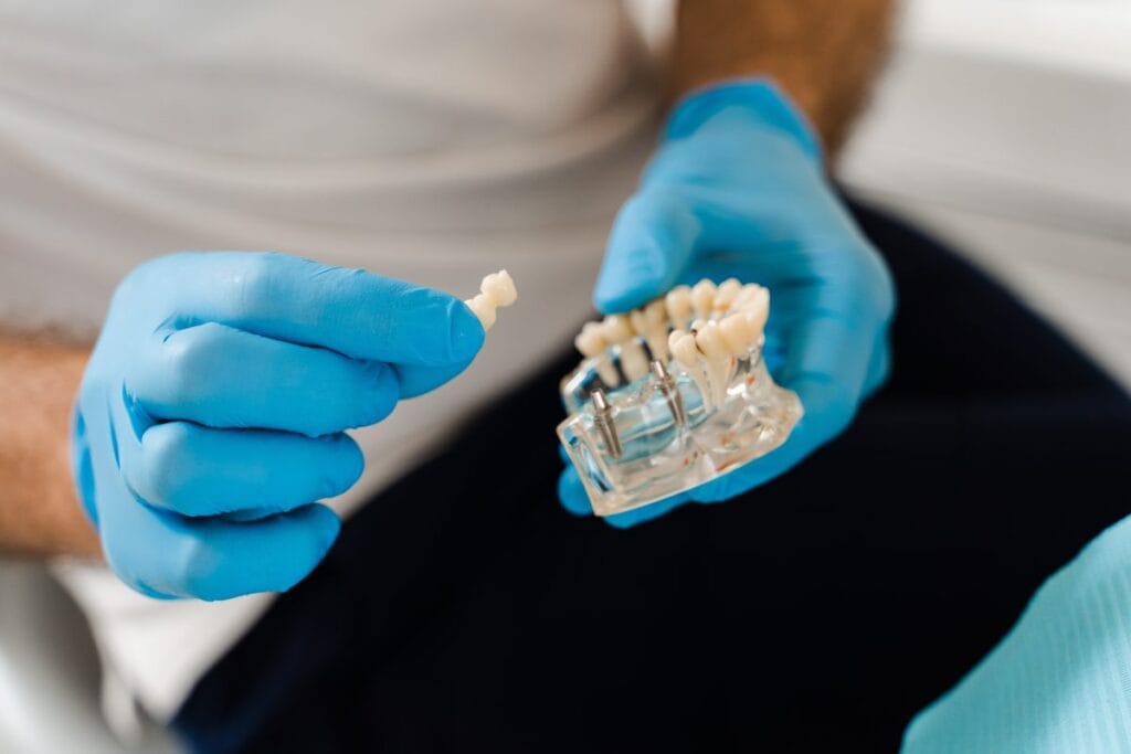 Dentist holding a dental implant model with a crown, showing how implants replace missing teeth